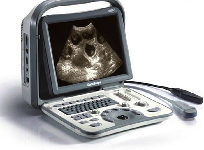 Pregnancy-Scanning